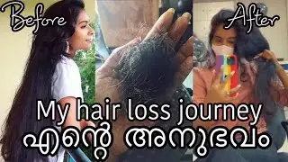 How I am trying to grow back my hair WITHOUT any treatments | Live results |Asvi Malayalam