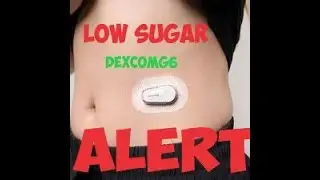 Dexcom Low Sugar Alert!