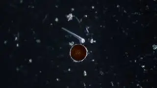 Arcella sp. (Testate amoeba) - Protozoans and other small critters