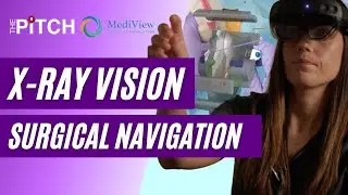 3D holographic visuals in the OR | OTW's THE PITCH