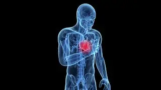 Flu could raise heart attack risk, Canadian study says