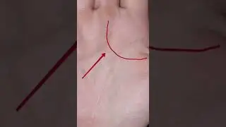 знаки травм и ранений