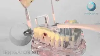 CURAPROX Hydrosonic Dental Care Set CHS 100 - звуковая зубная щетка с набором