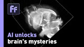 AI helps Johns Hopkins brain lab to unlock neuroscience mysteries