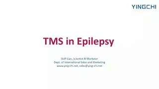What Are The Benefits And Safety of TMS in the Treatment of Epilepsy?