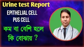 Epithelial cell & PUS Cell কম বা বেশি হলে কি বোঝায়।।