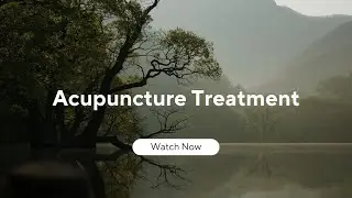 Acupuncture Treatment