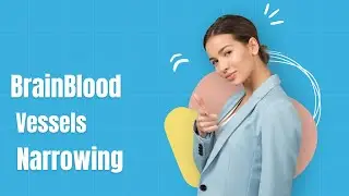 7 Warning Signs Your Brain Blood Vessels Are Narrowing