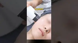 SUNNY &mdash; Customizable Energy for Advanced Skin Treatments #laser