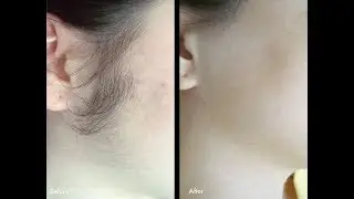 NEUD HAIR INHIBITOR FOR PERMANENT BODY HAIR REMOVAL | SuperPrincessjo