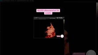 Seeing baby girl in 4D/5D ultrasound at 28 weeks #4dultrasound