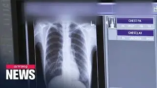 S. Korean researchers develop digital X-rays with reduced radiation exposure