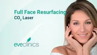 Full Face CO2 Laser Resurfacing Procedure | UK Clinic Demonstration