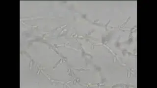Candida Tropicalis (RIFE Healing Frequency)