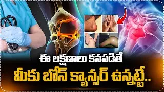 If you see these symptoms, you may have bone cancer..| Bone Cancer Causes and Symptoms | Bone Can...