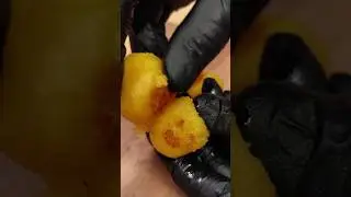 Crispy Potato Balls😋#crispy #potato #tasty #party #snacks