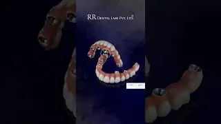 Precision Smiles Start Here &ndash; RR Dental Lab: Excellence in Dental Restoration