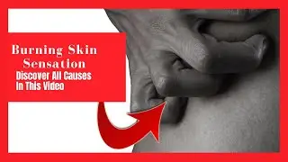 Why I Feel Burning Skin Sensation ? ➞ 【 Skin Burning Sensation Discover All Causes】