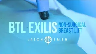 Non-Surgical Breast Lift |  Laser Breast Lift | BTL Exilis | Radiofrequency Skin Tightening