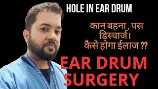 Treatment for Hole in Ear Drum, Ear Surgery for discharging ear . #EarDrum #surgery #tympanoplasty