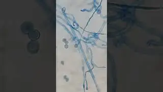 Conidia and conidiophores of Fungi #fungus #shorts