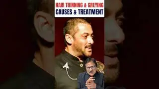 Why Is Your Hair Thinning or Turning White Early? 4 Causes & Treatments | #HairCare #trending
