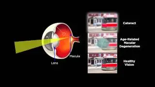Platinum Naturals Professional Series: Total Vision Care&trade;