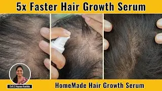 5x Faster Hair Growth Serum | Home Made Hair Growth Serum | Panchayu