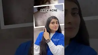 How to get rid of back acne | How to get rid of body odor | How to prevent pimples | Ingrown hair