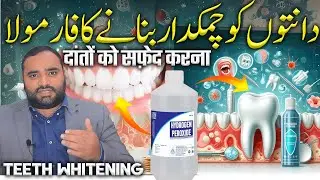 danto ko chamakdar banane ka formula | hydrogen peroxide teeth cleaning | Dr Aqeel Maqsood