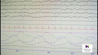 Sleep Technology with Audio Description