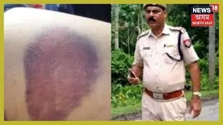 The Three Women Were Not Beaten By Mahendra Sharma According To Medical Reports