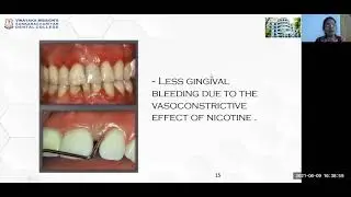 Dr Priya   Smoking and Periodontal Disease