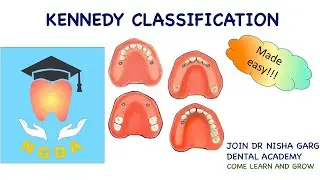 KENNEDY CLASSIFICATION | MADE EASY | DR NISHA GARG DENTAL ACADEMY