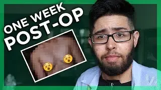 1 WEEK POST-OP UPDATE
