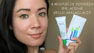 👧🏻 SKIN UPDATE [#2]: 9 Months of Differin, Before + Afters of Acne Scars | MICHXMASH