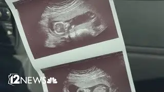 Pregnant Arizona woman delaying cancer treatment to protect her unborn child
