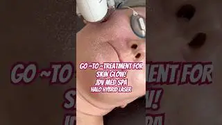 Go~To~Treatmemt for GLOWING SKIN!! #laser #shortsfeed #skintreatment