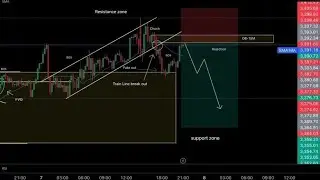 Advise for beginners in forex trading 💵💰📈