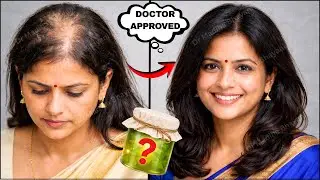 100 X Fastest BALD (GANJPAN) Hair Oil | Strongest Moringa Oil For Hair Growth by Dr Madiha Bhayani