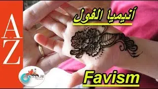 Favism | From A to Z |  انيميا الفول | الاعراض | مسببات المرض| كيفية تجنبه | كل اربعاء