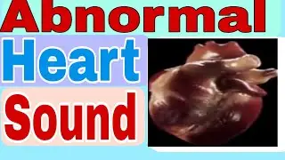 Abnormal heart sound 
