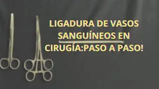 LIGADURA DE VASOS SANGUINEOS: PASO A PASO!