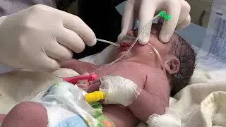 Critical NICU Baby | Delayed Cry at Birth | Low Oxygen & Emergency Care 💙