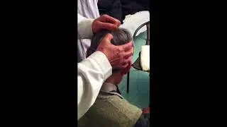 Dr Wang Ju-yi needles Hou Ding point