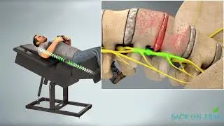 Back On Trac Spinal Decompression Chair