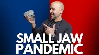 The Small Jaw Pandemic: How Modern Life Is Reshaping Our Faces