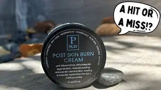 Post Skin Burn Cream, Sunburn Cream for First Aid Treatment, Hydrates & Repairs Skin Review