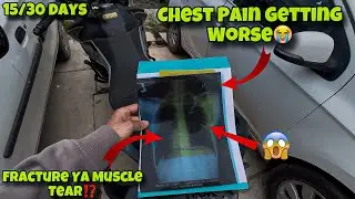 Chest Pain After Bike Crash 😰 | X-Ray Report From Barsar Hospital | Day 15