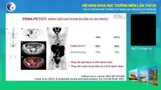 2. PET/CT trong theranostic v&agrave; ứng dụng l&acirc;m s&agrave;ng (PGS.TS. L&ecirc; Ngọc H&agrave;)